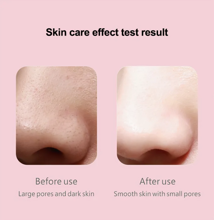 Blackhead Removal Machine – Advanced Pore Cleaning Tool for Smooth Skin