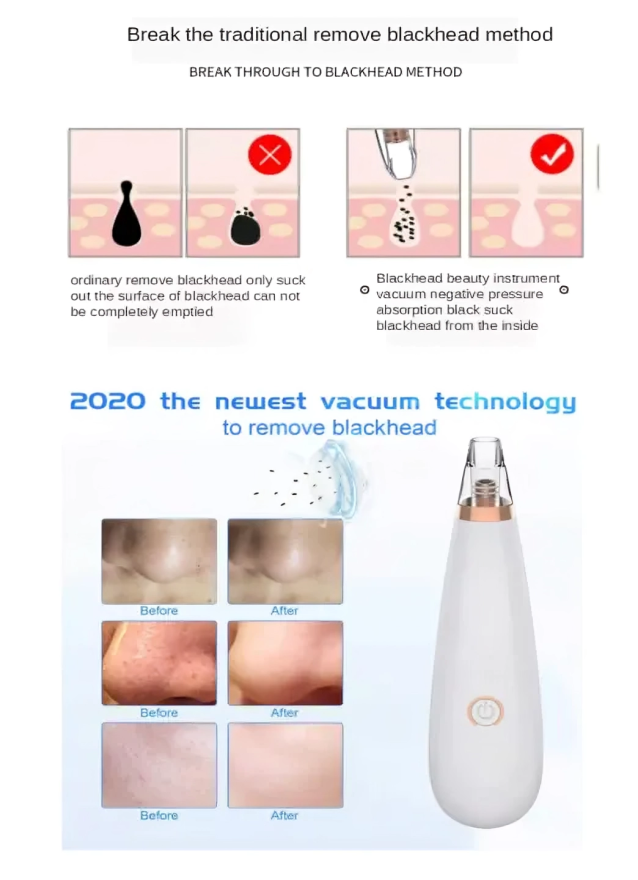 Blackhead Removal Machine – Advanced Pore Cleaning Tool for Smooth Skin